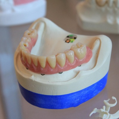 Chess Lessons Dubai | Zubna tehnika