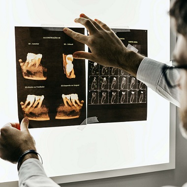 Chess Lessons Dubai | Zubni implanti Beograd